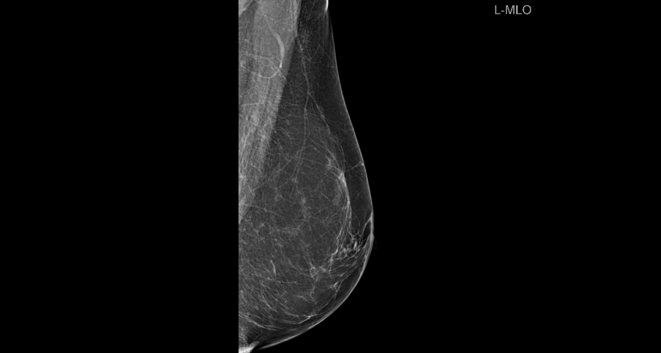 Poliklinika Affidea Vita svojim pacijenticama nudi besplatne preglede dojki!