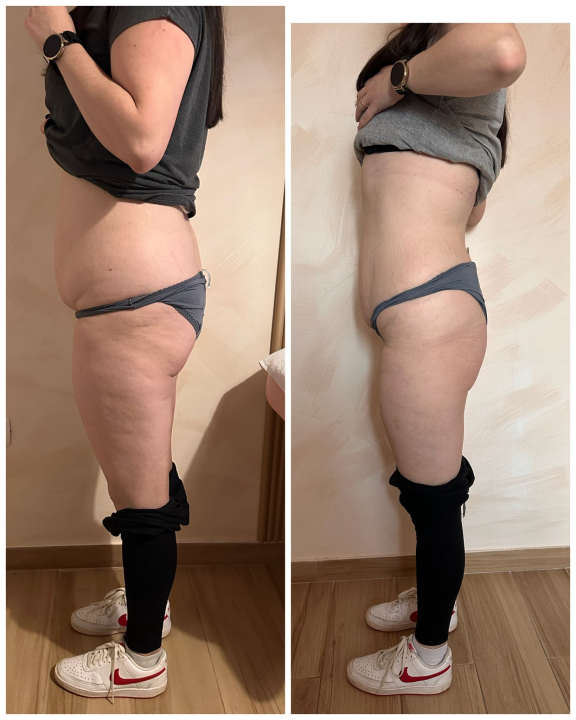 FOTO Skinite do 10 kilograma u 6 tjedana uz Beauty Clinic by Tamara