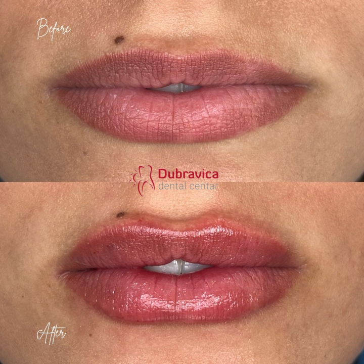 FOTO Dan žena u Dubravici: Iskoristite popust na najnovije trendove u estetskoj medicini 