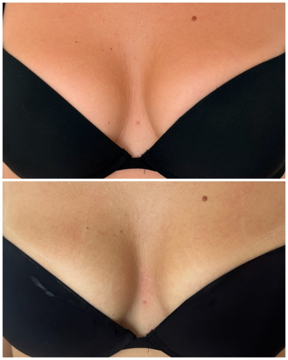 FOTO Želite zategnutiju kožu, ali ne želite pod nož? Tamara ima rješenje koje tražite!