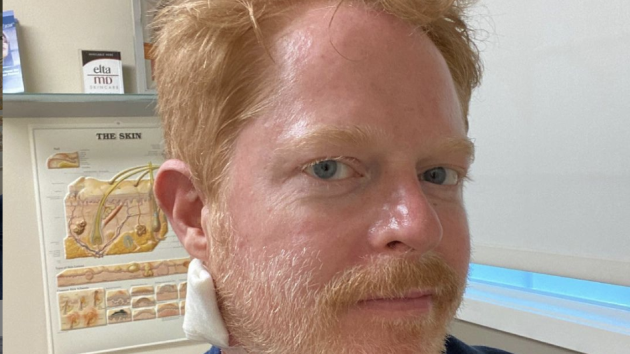 Jesse Tyler Ferguson operiran: Uklonili su mi 'malo raka', ok sam