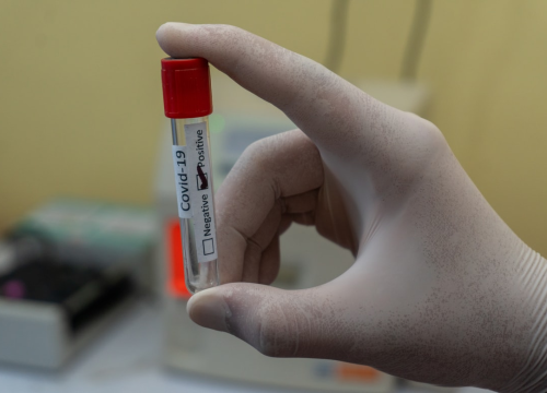 Beroš potvrdio: I brzi test bit će dovoljan za dokazivanje covida