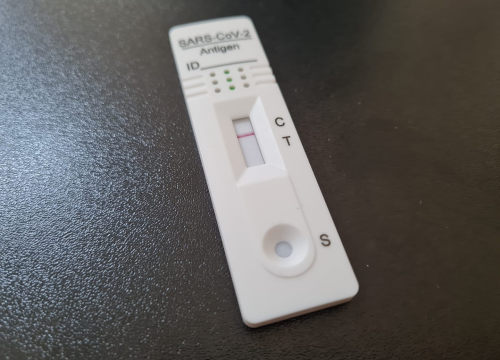 Zašto se neki ljudi ne mogu zaraziti koronom?