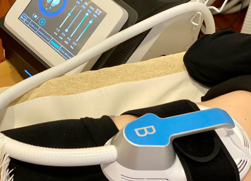 Fotografija 4 - Pripremite se za ljeto uz promo cijene na zamrzavanje sala u Beauty Baru Tamara!