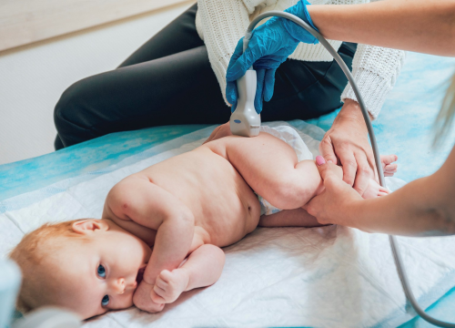 Obavite ortopedski pregled vaše bebe u Poliklinici Gemini!