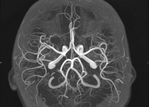 Fotografija 6 - Naručite se na rendgen, ultrazvuk, CT ili MR u Poliklinici Affidea Vita