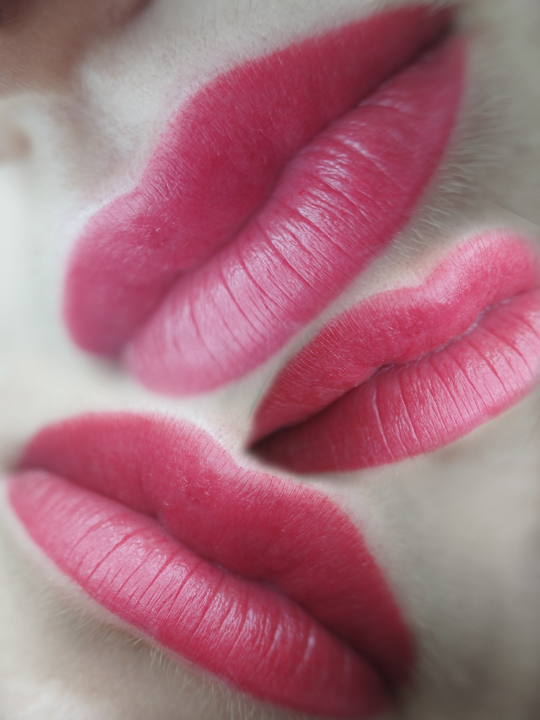 Riješite se uraslih noktiju uz medicinsku pedikuru!