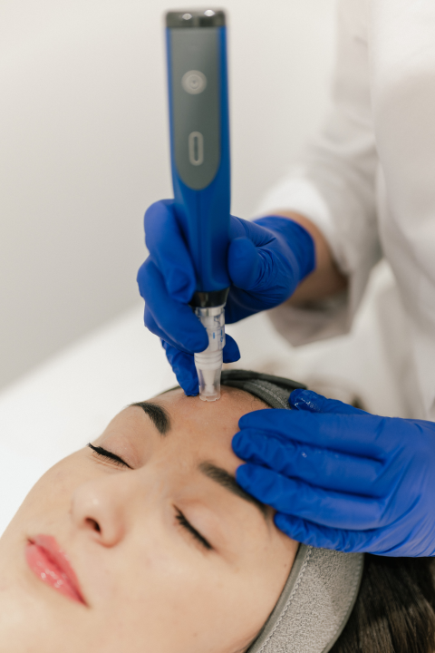 Obnovite svoju kožu vrhunskim dermatološkim tretmanima Poliklinike Krešimir