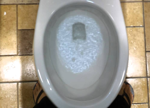 Izbjegavate putovanja ili druženja zbog čestih odlazaka na toalet? Možda patite od ovog sindroma