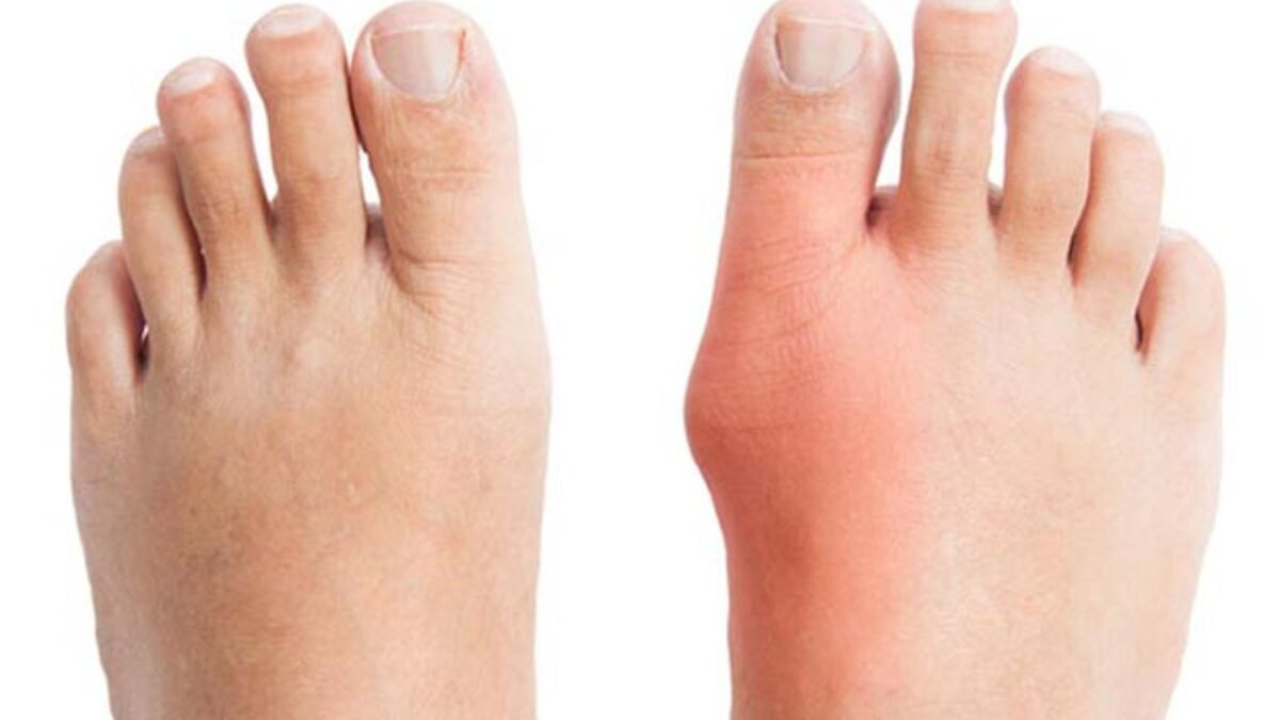 Obratite pažnju na stopala: Ona mogu ukazivati na neke bolesti