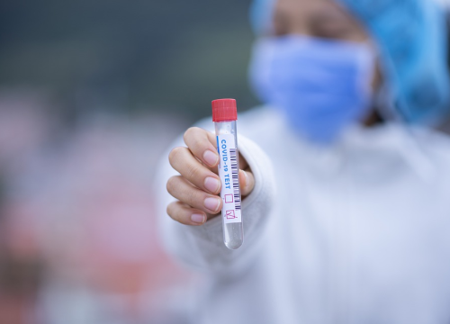 Kada ima smisla napraviti serološki test i jesmo li sigurni ako imamo veliku količinu antitijela?