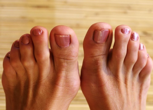 Liječnik objasnio zašto stopala znaju imati neugodna miris: 'Ali, to je zapravo dobro za vas'