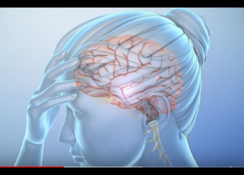 Nedostatak određenih elemenata u organizmu prouzrokuju glavobolju