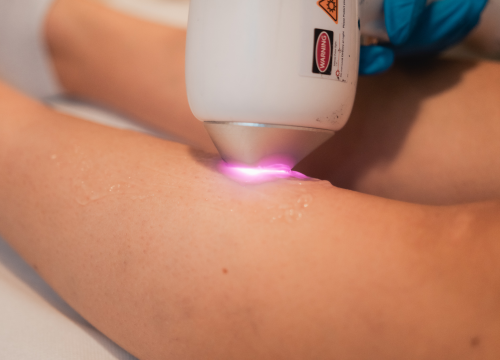 Fotografija 11 - Beauty bar Tamara časti vas vrhunskim popustima na brojne tretmane za uljepšavanje i njegu tijela!