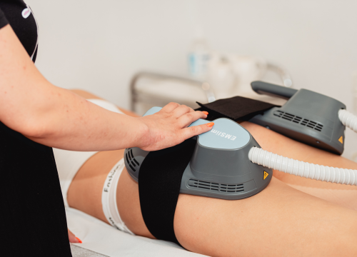 Fotografija 10 - Postignite svoj cilj uz personalizirani program Beauty Bara Tamara!