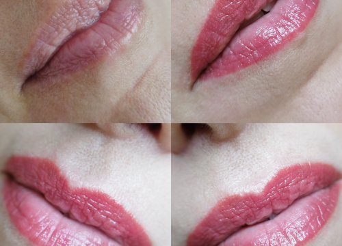 Fotografija 6 - Pružite svojim stopalima maksimalnu njegu i riješite tegobe uz medicinsku pedikuru!