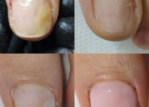 Fotografija 12 - Iskoristite odlične popuste na trajnu šminku kod Jelene Radak!