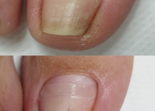 Fotografija 15 - Iskoristite odlične popuste na trajnu šminku kod Jelene Radak!