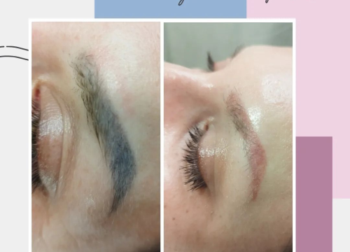 Fotografija 3 - Uz Glam by Ana uklonite trajnu šminku i tetovaže bez boli!