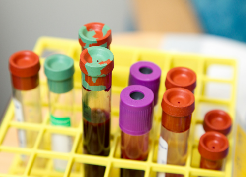 Evo kako krvna grupa utječe na vaše zdravlje