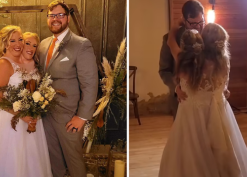 Abby i Brittany sijamske su blizanke: Voze auto, a jedna od njih se i udala