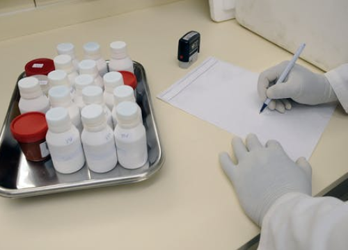 Ova krvna grupa povezana je s većim rizikom od ranog moždanog udara