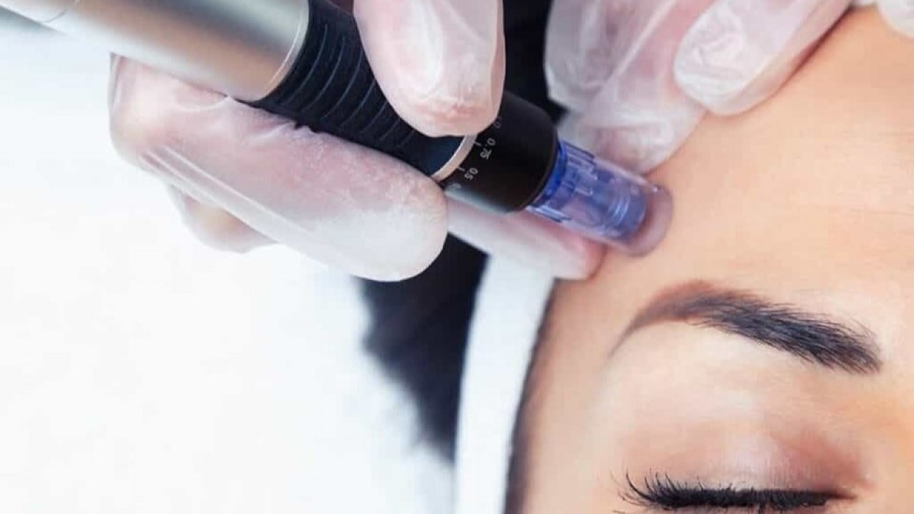 Poliklinika Gemini: Pomladite svoju kožu uz popust od 20 posto