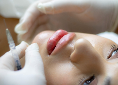 Dan žena u Dubravici: Iskoristite popust na najnovije trendove u estetskoj medicini