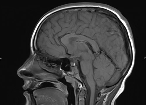 Fotografija 2 - FOTO Naručite se na rendgen, ultrazvuk, CT ili MR u Poliklinici Affidea Vita!