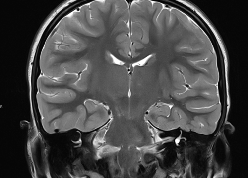 Fotografija 9 - FOTO Naručite se na rendgen, ultrazvuk, CT ili MR u Poliklinici Affidea Vita!